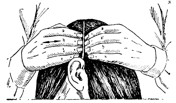 Рис. 34. Схема массажа головы по боковому пробору