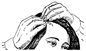 Рис. 35. Схема массажа головы по боковому пробору